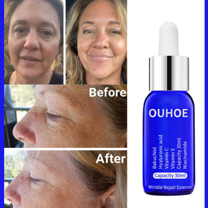Anti-Wrinkle Lifting Facial Oil Serum for Firm Skin